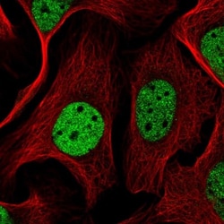 SGTA Antibody, Novus Biologicals 25 &mu;L; Unlabeled:Antibodies, Polyclonal